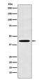 TNF Receptor Superfamily Member 19 antibody, M06157-2, Boster Biological Technology, Western Blot image 