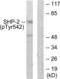 Protein Tyrosine Phosphatase Non-Receptor Type 11 antibody, LS-C199571, Lifespan Biosciences, Western Blot image 