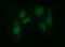 ADAM Metallopeptidase With Thrombospondin Type 1 Motif 8 antibody, M09769, Boster Biological Technology, Immunofluorescence image 