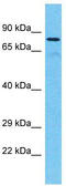 Tetratricopeptide Repeat Domain 30A antibody, TA330806, Origene, Western Blot image 