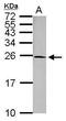 Myosin Light Chain 1 antibody, PA5-29635, Invitrogen Antibodies, Western Blot image 