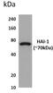 Serine Peptidase Inhibitor, Kunitz Type 1 antibody, GTX52775, GeneTex, Western Blot image 