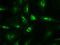 Neurotrophin 4 antibody, GTX83981, GeneTex, Immunocytochemistry image 