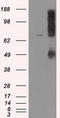 Lysyl Oxidase antibody, LS-C114937, Lifespan Biosciences, Western Blot image 