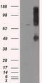 Protein-lysine 6-oxidase antibody, LS-C114937, Lifespan Biosciences, Western Blot image 