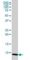 Cytochrome C Oxidase Subunit 6B1 antibody, H00001340-M01, Novus Biologicals, Western Blot image 