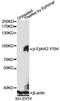 EPH Receptor A2 antibody, LS-C750624, Lifespan Biosciences, Western Blot image 