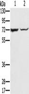 Solute Carrier Family 25 Member 13 antibody, TA350420, Origene, Western Blot image 
