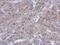 Zeta Chain Of T Cell Receptor Associated Protein Kinase 70 antibody, PA5-28697, Invitrogen Antibodies, Immunohistochemistry frozen image 