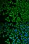 Checkpoint Kinase 2 antibody, LS-C746740, Lifespan Biosciences, Immunofluorescence image 