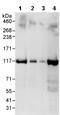 ERCC Excision Repair 4, Endonuclease Catalytic Subunit antibody, ab76948, Abcam, Western Blot image 