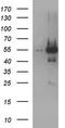 Ankyrin repeat and MYND domain-containing protein 2 antibody, TA507314, Origene, Western Blot image 
