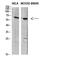 Solute Carrier Family 6 Member 1 antibody, STJ98949, St John