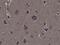 Ribosomal Protein S6 Kinase A1 antibody, GTX33600, GeneTex, Immunohistochemistry paraffin image 