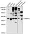 Prostate Transmembrane Protein, Androgen Induced 1 antibody, GTX64694, GeneTex, Western Blot image 