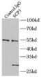 Synaptonemal Complex Protein 3 antibody, FNab07655, FineTest, Immunoprecipitation image 
