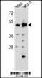 Aspartyl Aminopeptidase antibody, 56-078, ProSci, Western Blot image 