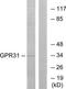 G Protein-Coupled Receptor 31 antibody, TA313950, Origene, Western Blot image 