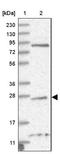 TPPP antibody, NBP1-80962, Novus Biologicals, Western Blot image 