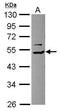 COP9 Signalosome Subunit 2 antibody, PA5-30309, Invitrogen Antibodies, Western Blot image 