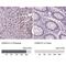 Cyclin Dependent Kinase Inhibitor 1C antibody, NBP1-89917, Novus Biologicals, Immunohistochemistry paraffin image 