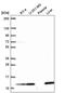 Transmembrane Protein 256 antibody, PA5-66525, Invitrogen Antibodies, Western Blot image 