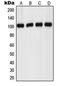 Probable G-protein coupled receptor 110 antibody, LS-C353675, Lifespan Biosciences, Western Blot image 