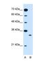 Solute Carrier Family 25 Member 22 antibody, NBP1-59603, Novus Biologicals, Western Blot image 