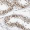 Wnt Family Member 7A antibody, NBP1-86071, Novus Biologicals, Immunohistochemistry paraffin image 