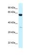 Hexokinase 1 antibody, orb331118, Biorbyt, Western Blot image 