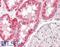 NADH-ubiquinone oxidoreductase chain 6 antibody, LS-B8197, Lifespan Biosciences, Immunohistochemistry frozen image 