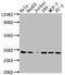 Cyclin Dependent Kinase 4 antibody, CSB-RA965615A0HU, Cusabio, Western Blot image 