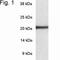 Proteasome Subunit Beta 8 antibody, NB120-3329, Novus Biologicals, Western Blot image 
