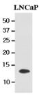 Tubulin Folding Cofactor A antibody, GTX50016, GeneTex, Western Blot image 