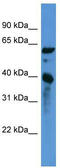 Calponin 3 antibody, TA342810, Origene, Western Blot image 
