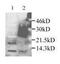 C-C Motif Chemokine Ligand 2 antibody, PA1-22488, Invitrogen Antibodies, Western Blot image 