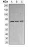 Poly(A)-Specific Ribonuclease antibody, orb341200, Biorbyt, Western Blot image 