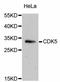 Cyclin Dependent Kinase 5 antibody, abx125318, Abbexa, Western Blot image 