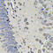 Eukaryotic Translation Initiation Factor 3 Subunit C antibody, STJ29102, St John