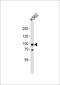 Smoothened, Frizzled Class Receptor antibody, PA5-72395, Invitrogen Antibodies, Western Blot image 