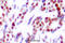 Activating Transcription Factor 2 antibody, A00916S112, Boster Biological Technology, Immunohistochemistry paraffin image 