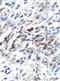 Matrix Metallopeptidase 14 antibody, orb11058, Biorbyt, Immunohistochemistry paraffin image 