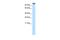 Myocardin Related Transcription Factor A antibody, PA5-68893, Invitrogen Antibodies, Western Blot image 