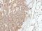 Involucrin antibody, PA5-30582, Invitrogen Antibodies, Immunohistochemistry paraffin image 