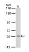 Cell Division Cycle 73 antibody, NBP1-32972, Novus Biologicals, Western Blot image 