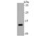Presenilin Enhancer, Gamma-Secretase Subunit antibody, NBP2-75632, Novus Biologicals, Western Blot image 
