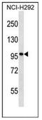 Dispatched RND Transporter Family Member 3 antibody, AP53502PU-N, Origene, Western Blot image 