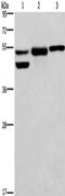 G Protein-Coupled Estrogen Receptor 1 antibody, CSB-PA934518, Cusabio, Western Blot image 