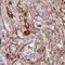 Lysyl Oxidase Like 4 antibody, NBP2-32692, Novus Biologicals, Immunohistochemistry frozen image 