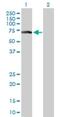 Zinc Finger Protein 18 antibody, H00007566-D01P, Novus Biologicals, Western Blot image 